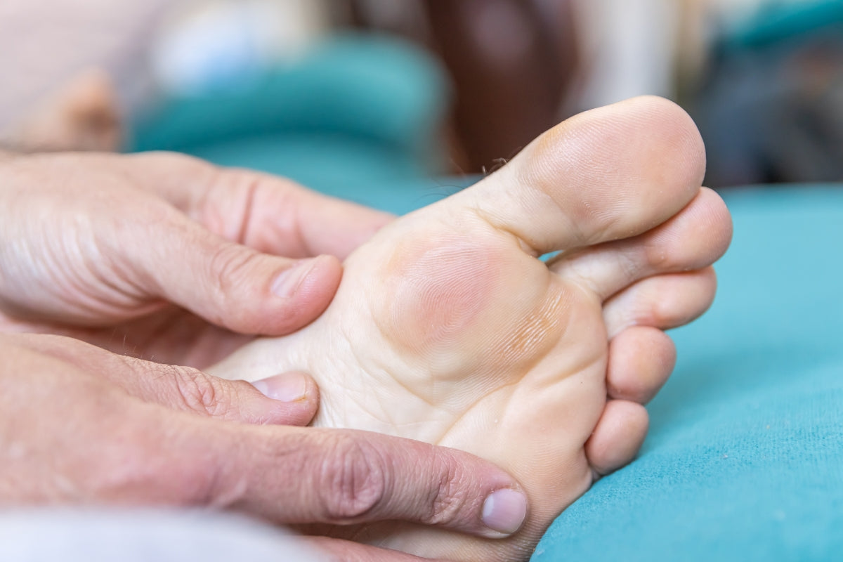 How to Prevent Foot Blisters: A Complete Guide for Athletes and Everyday Activities