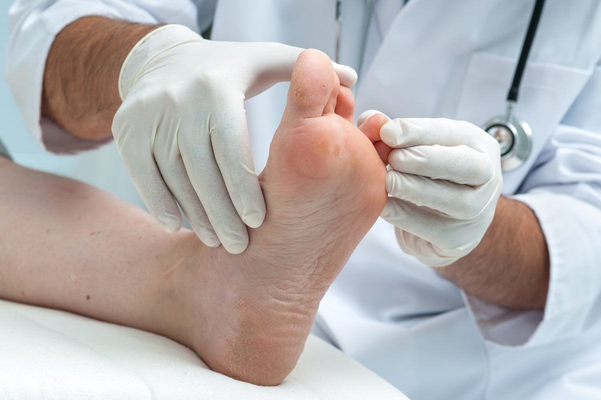 Athlete's foot: causes, treatment, and prevention guide
